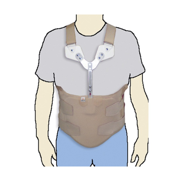 Orliman Placa Moldável de Apoio do Esterno - Farmácia Rodrigues Rocha