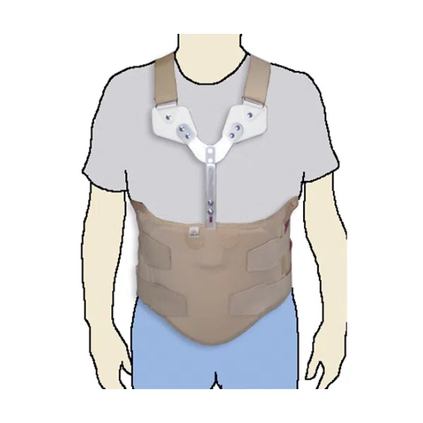 Orliman Placa Moldável de Apoio do Esterno - Farmácia Rodrigues Rocha