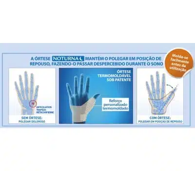 products-epitact_ortese_noturna_funcionalidade
