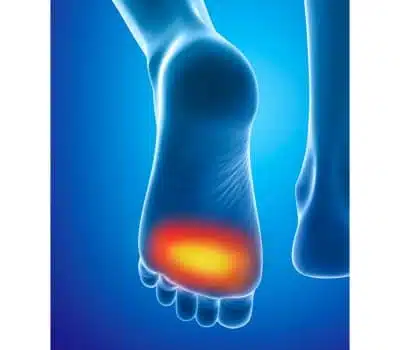 products-epitact_protecoes_calos_pes