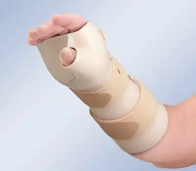 Orliman Tala Imobilizadora de Pulso e Polegar com Flexão Dorsal