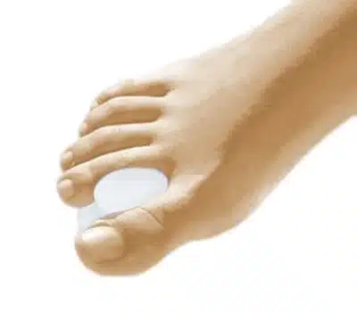 Sofy-Plant Gel Separador Carrete - 2 Unidades